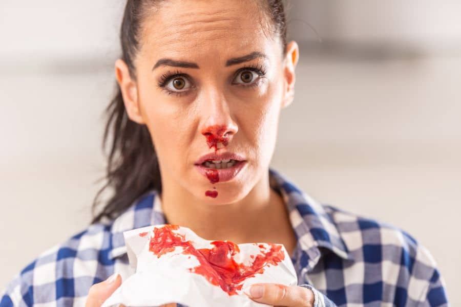 dream about nose bleed
