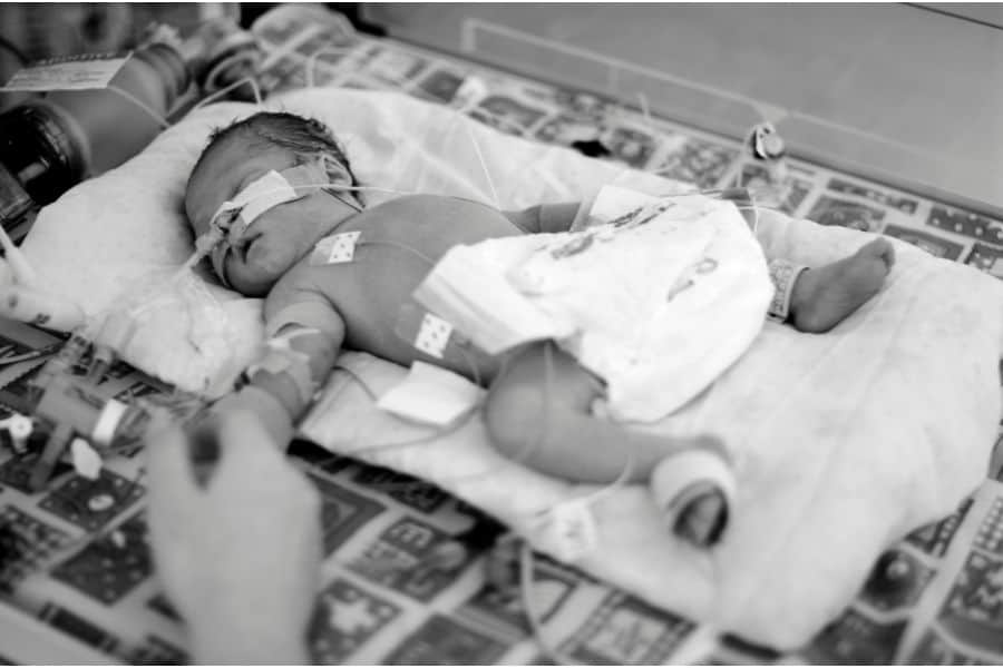 dream of baby dying